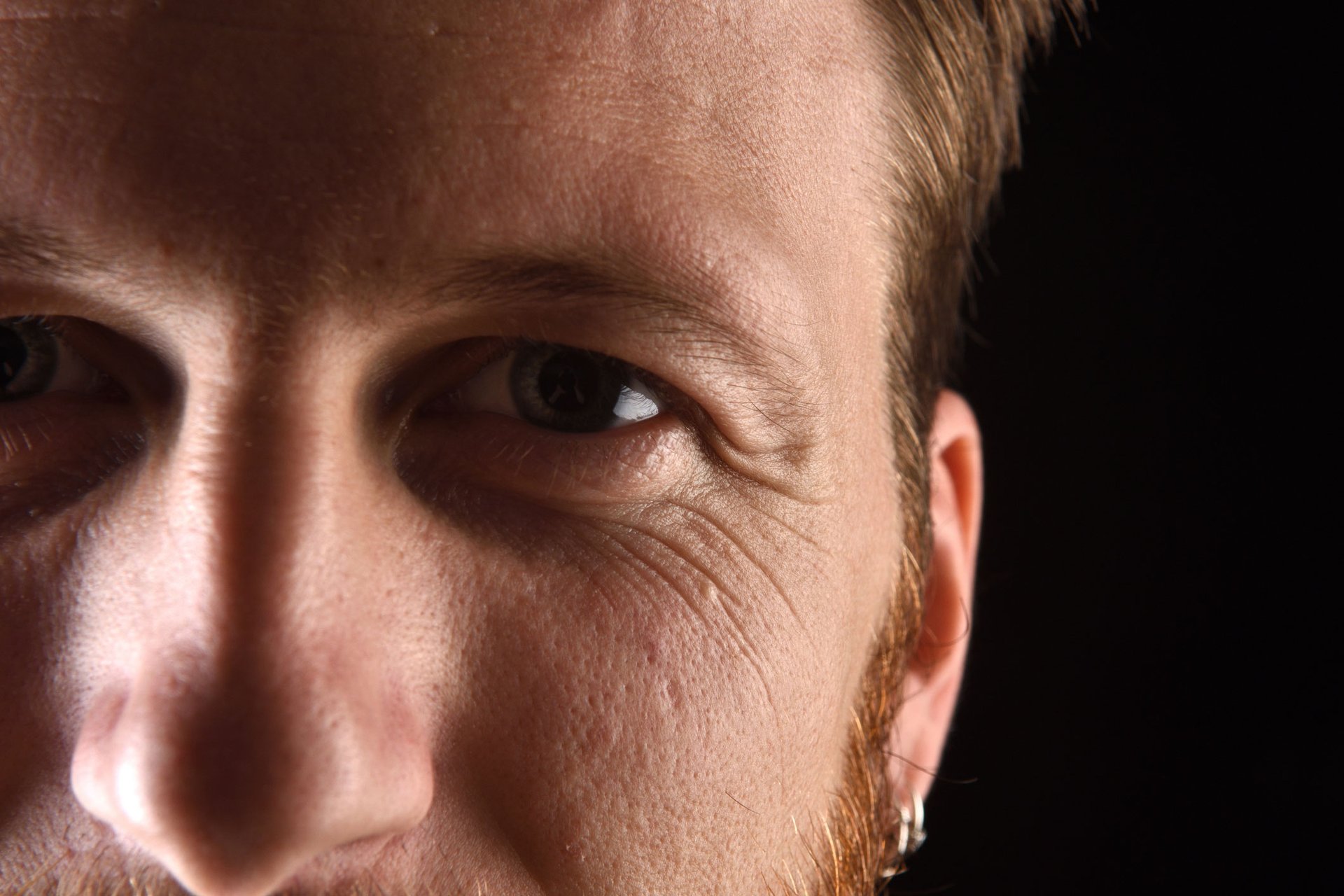 Nahaufnahme der rechten Gesichtshälfte eines Mannes mit Krähenfüßen um das Auge.