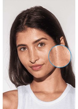 Frau mit Sommersprossen im Gesicht