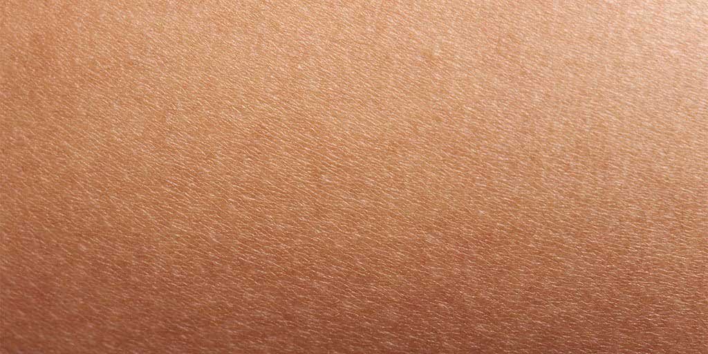 Larocheposay ArticlePage Eczema Dry skin vs eczema
