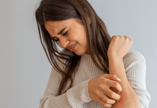 Seborrhoische Dermatitis: Frau kratzt sich am Arm