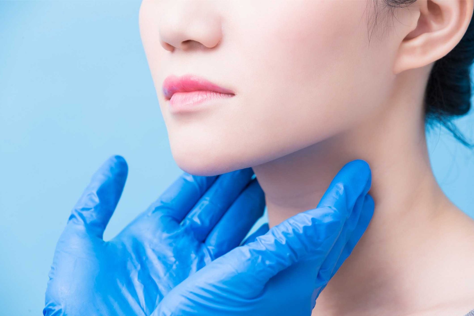 Larocheposay ArticlePage Adult acne affects increasing numbers of women