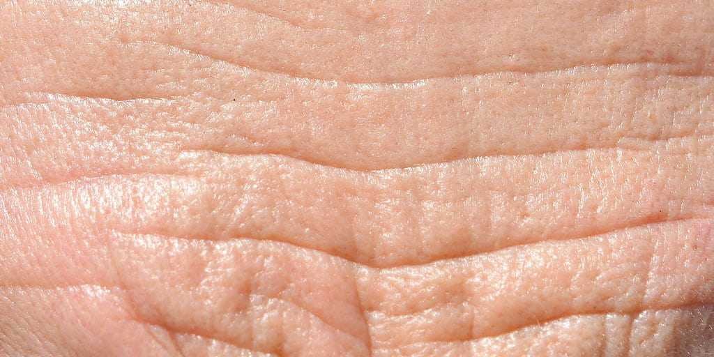 LarocheposayArticlePageSunSuninducedpigmentationaging