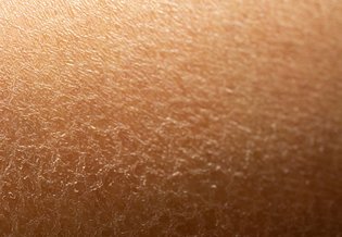 Larocheposay ArticlePage Sensitive Dehydrated skin 