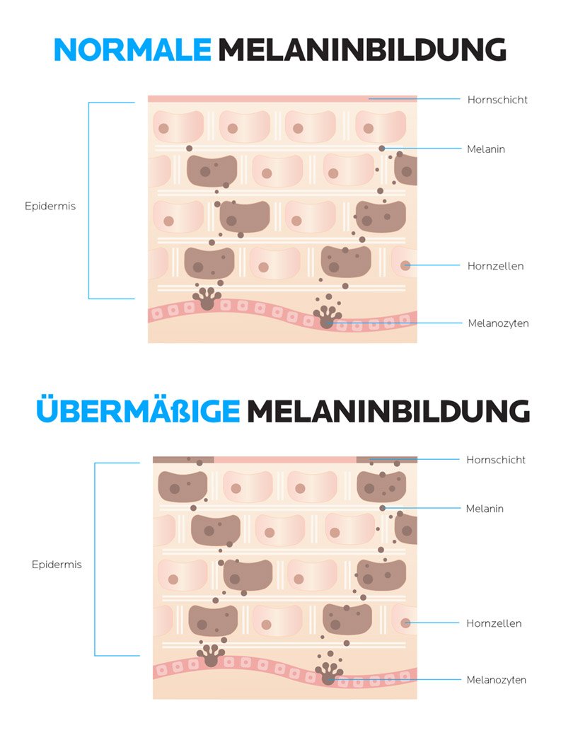 Schwangere Frau cremt ihren Bauch ein