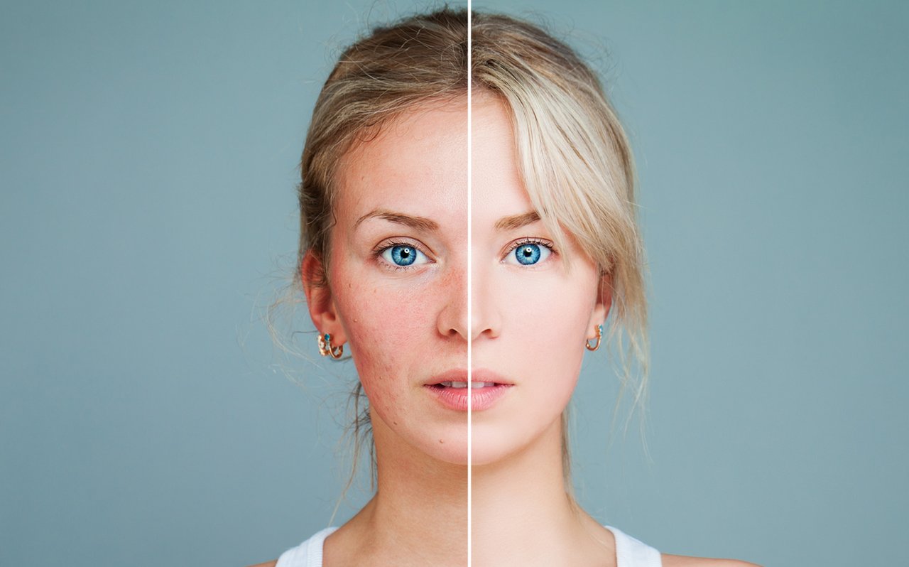 Allergische Reaktion Gesicht Frau