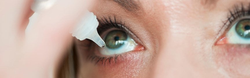 Frau tropft sich Augentropfen ins Auge