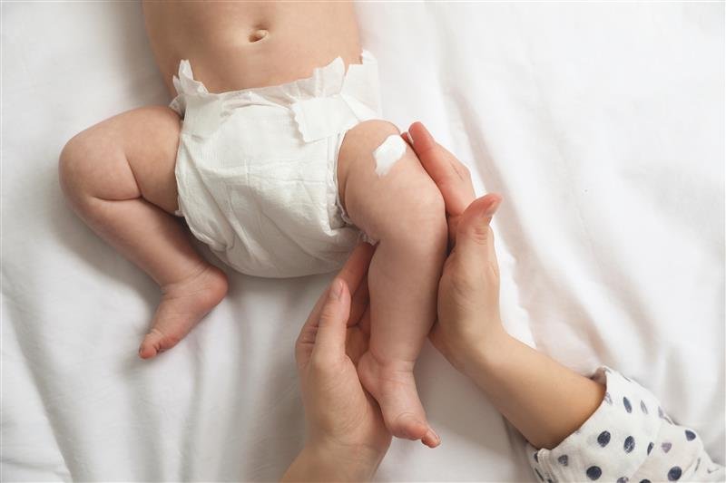 Hautpflege bei einem Baby mit Windelekzem