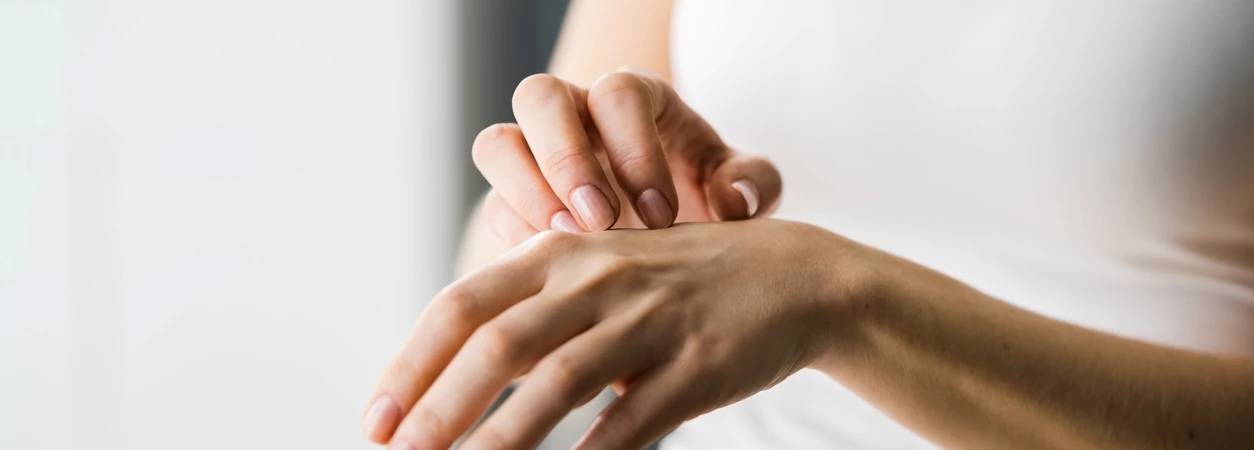 Juckreiz: Frau kratzt sich an der Hand