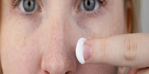 Schuppige Haut: Frau cremt ihre Nase ein