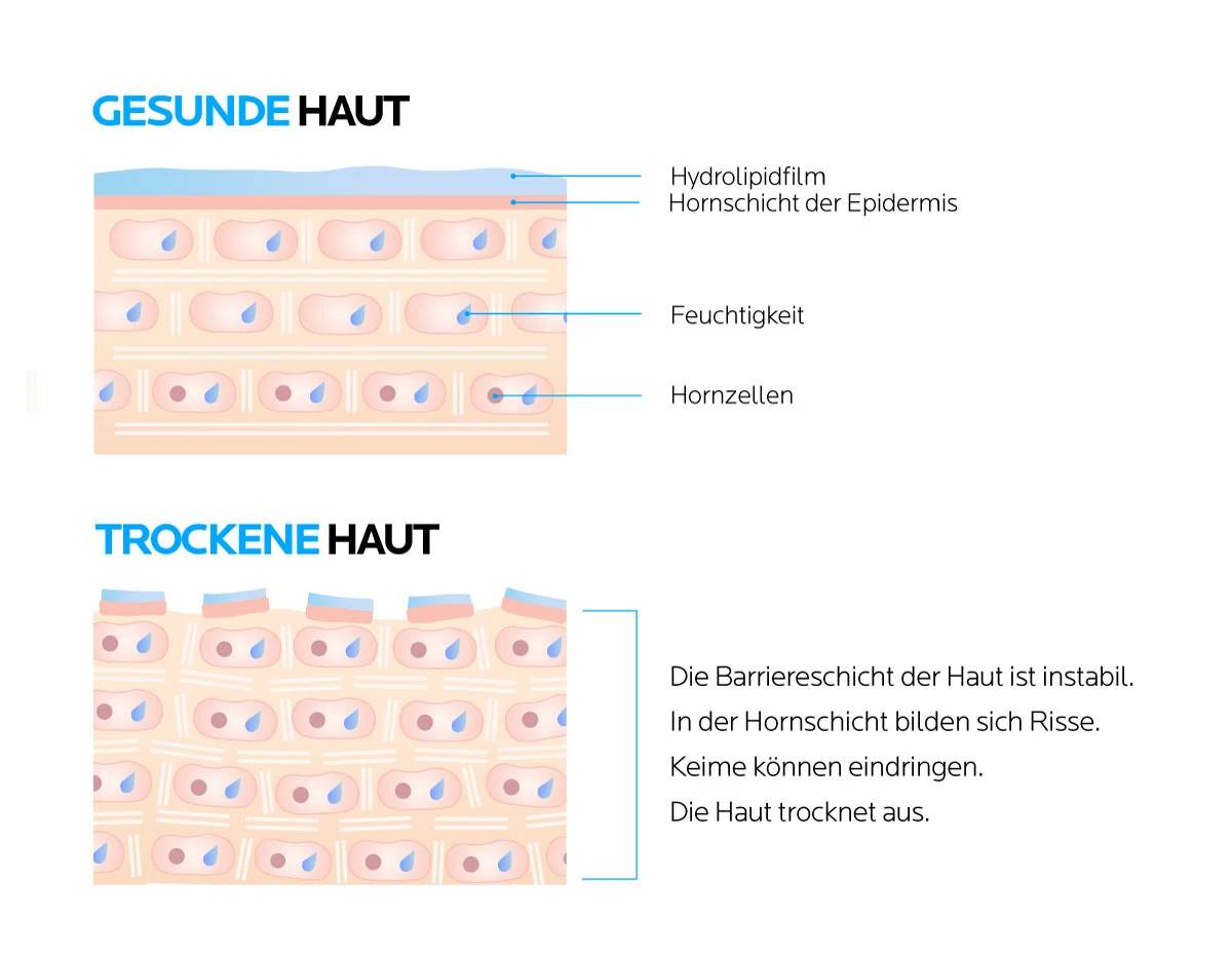 Trockene Haut am Körper richtig pflegen La Roche Posay