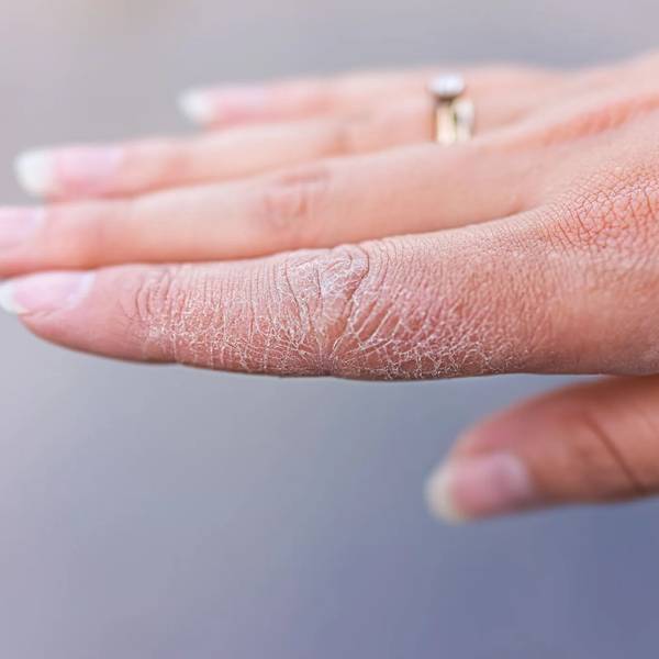 6 Stück (3 Paar) weiße Baumwollhandschuhe für trockene Hände, feuchtigkeitsspendend, Kosmetik, Ekzem, Spa und Münzschmuck, Inspektion, Servierhandsc 6 Stück (3 Paar) weiße Baumwollhandschuhe für trockene Hände, feuchtigkeitsspendend, Kosmetik, Ekzem, Spa und Münzschmuck, Inspektion, Servierhandsc