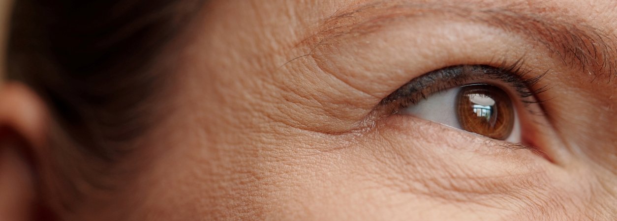 Gesicht einer Frau mit leichten Falten rund um die Augenpartie 