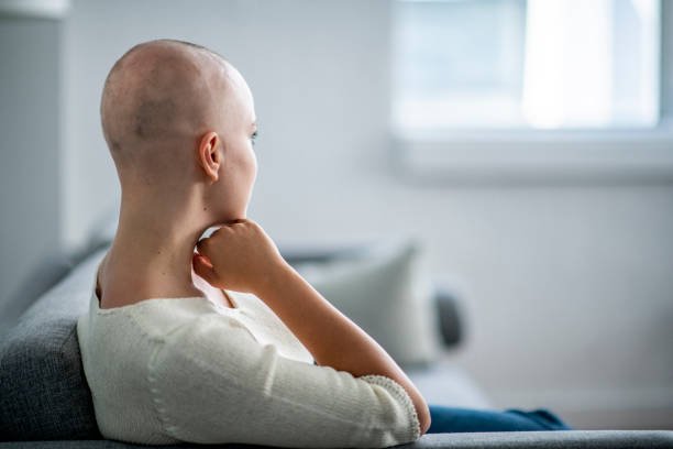 Einer Krebspatientin die ihre HAare verloren hat sitz auf einem sofa und stüzt dabei ihren kopf 
