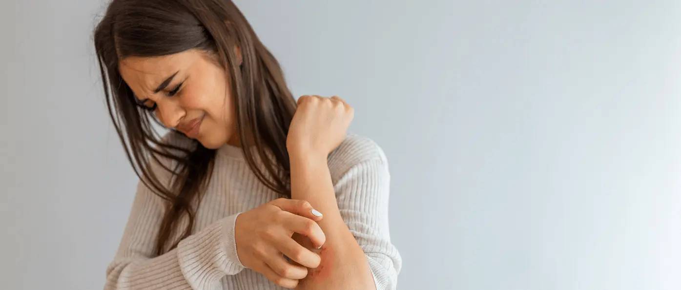 Frau mit Neurodermitis kratzt sich am Arm