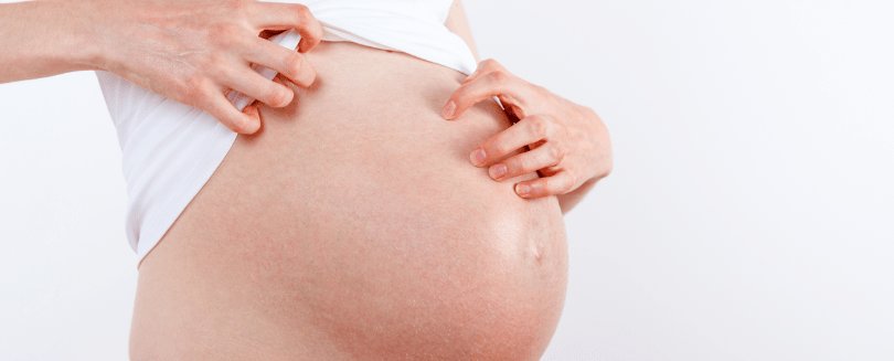 Was Ist Neurodermitis Ursachen Und Losungen Hier Finden Sie Alles Was Sie Wissen Sollten Atopisches Ekzem Und Neurodermitis La Roche Posay Hautpflege Bei Atopischem Ekzem La Roche Posay Von La Roche Posay