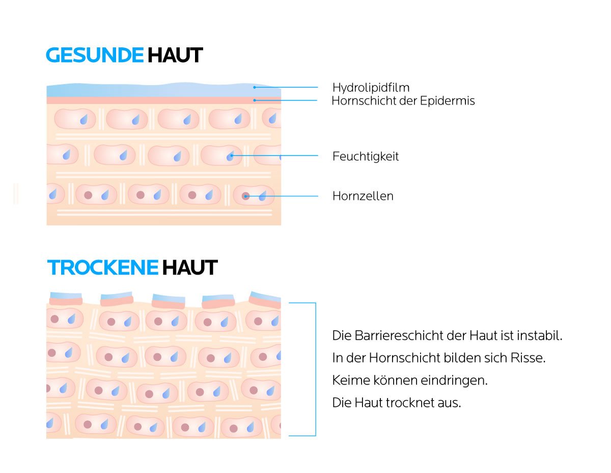 Unterschied gesunde und trockene Haut