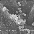v_microbiome_02