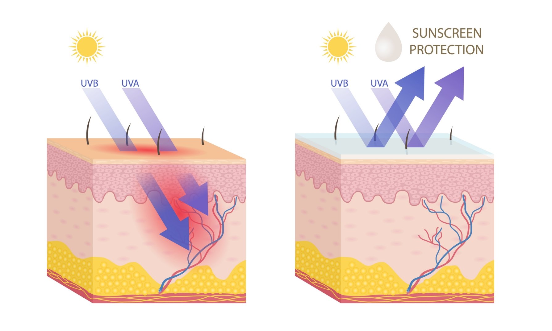 UVA- & UVB-Strahlen bei Nutzung von Sonnenpflege 